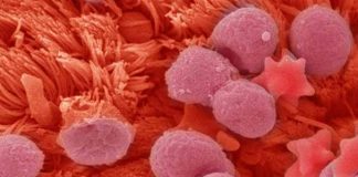 L’innovazione CRISPR blocca la replicazione del virus SARS-CoV-2 nei primi test di laboratorio