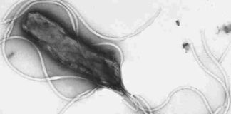 Un caso di cancro su otto nel mondo è legato a infezioni, secondo uno studio